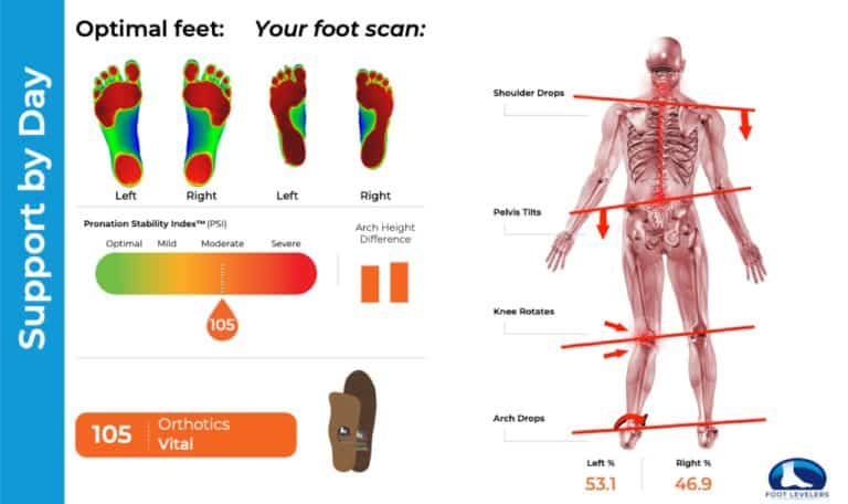 Foot Scan for Orthotics