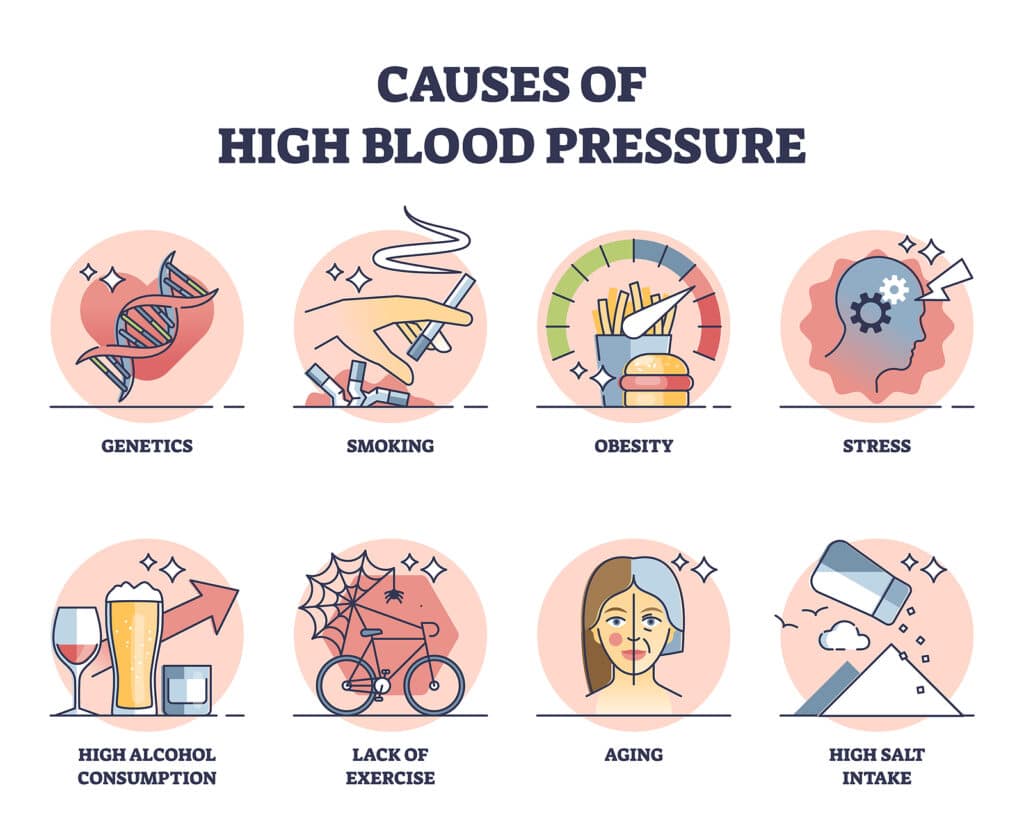 Causes of high blood pressure with cardiology risks outline collection set. Labeled educational scheme with unhealthy lifestyle factors that impact heart vector illustration. Medical disease triggers.